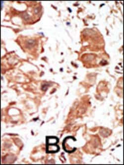 Invitrogen PIM1 Polyclonal Antibody 400 &mu;L; Unconjugated:Antibodies,