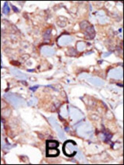 Invitrogen MLCK Polyclonal Antibody 400 &mu;L; Unconjugated:Antibodies,