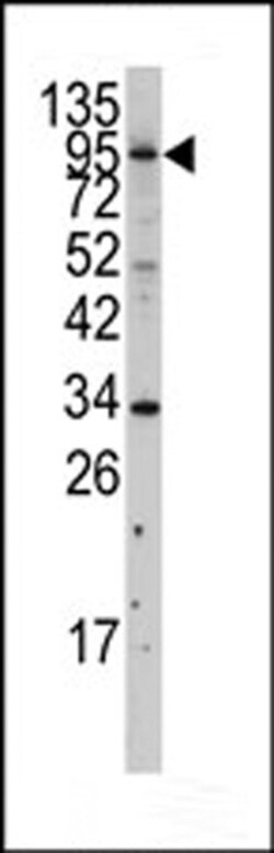 Invitrogen MLCK Polyclonal Antibody 400 &mu;L; Unconjugated:Antibodies,