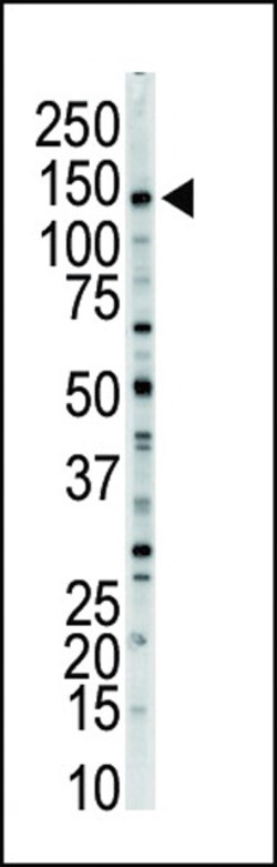Invitrogen MYLK Polyclonal Antibody 400 &mu;L; Unconjugated:Antibodies,