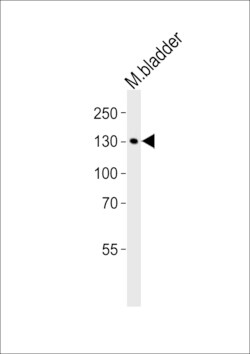 Invitrogen MYLK Polyclonal Antibody 400 &mu;L; Unconjugated:Antibodies,