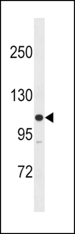 Invitrogen MYLK Polyclonal Antibody 400 &mu;L; Unconjugated:Antibodies,