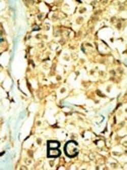Invitrogen TNIK Polyclonal Antibody 400 &mu;L; Unconjugated:Antibodies,