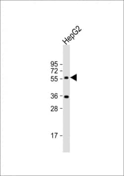 Invitrogen CYP7A1 Polyclonal Antibody 400 &mu;L; Unconjugated:Antibodies,
