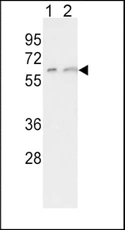 Invitrogen CYP7A1 Polyclonal Antibody 400 &mu;L; Unconjugated:Antibodies,