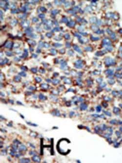 Invitrogen PIK3C2G Polyclonal Antibody 400 &mu;L; Unconjugated:Antibodies,