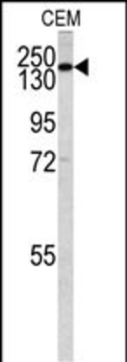Invitrogen PIK3C2G Polyclonal Antibody 400 &mu;L; Unconjugated:Antibodies,