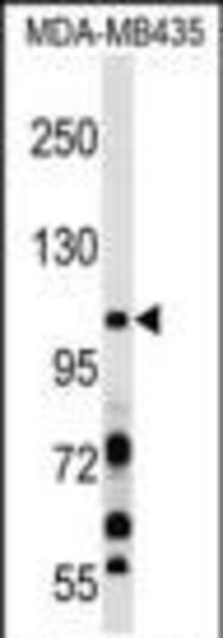 Invitrogen PIK3CB Polyclonal Antibody 400 &mu;L; Unconjugated:Antibodies,