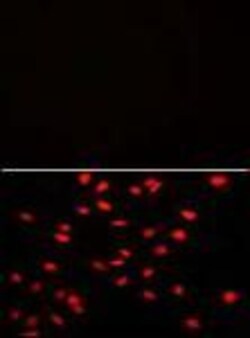 Invitrogen PI4K2A Polyclonal Antibody 400 &mu;L; Unconjugated:Antibodies,
