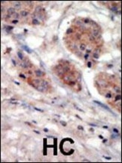 Invitrogen PI4K2A Polyclonal Antibody 400 &mu;L; Unconjugated:Antibodies,
