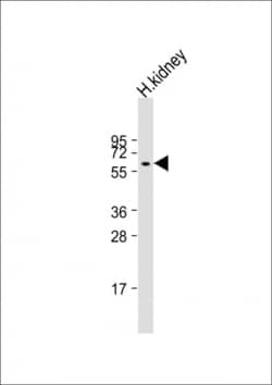 Invitrogen PI4K2A Polyclonal Antibody 400 &mu;L; Unconjugated:Antibodies,