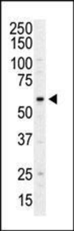 Invitrogen PI4K2A Polyclonal Antibody 400 &mu;L; Unconjugated:Antibodies,