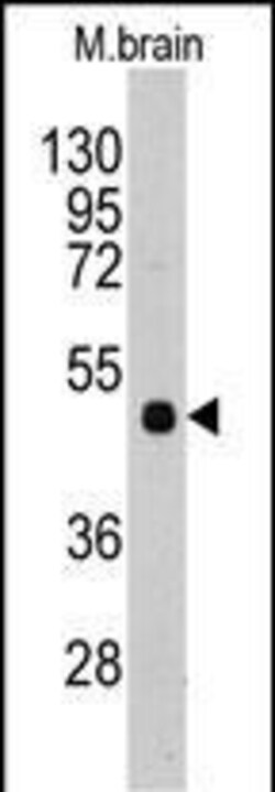 Invitrogen PI4K2A Polyclonal Antibody 400 &mu;L; Unconjugated:Antibodies,