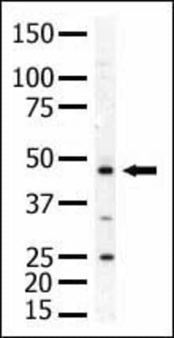 Invitrogen PIP4K2A Polyclonal Antibody 400 &mu;L; Unconjugated:Antikroppar