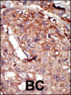 Invitrogen BRD2 Polyclonal Antibody 400 &mu;L; Unconjugated:Antibodies,