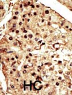 Invitrogen TRPM7 Polyclonal Antibody 400 μL; Unconjugated:Antibodies,