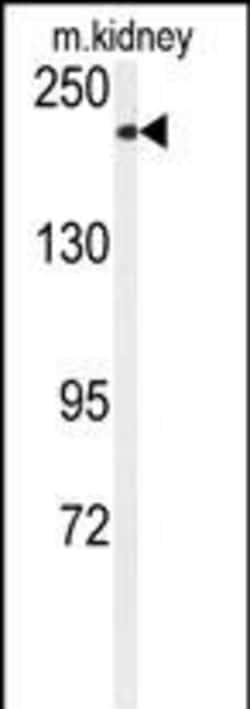 Invitrogen TRPM7 Polyclonal Antibody 400 μL; Unconjugated:Antibodies,