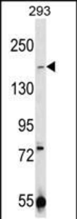 Invitrogen TRPM7 Polyclonal Antibody 400 μL; Unconjugated:Antibodies,