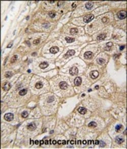 Invitrogen PERK Polyclonal Antibody 400 &mu;L; Unconjugated:Antibodies,