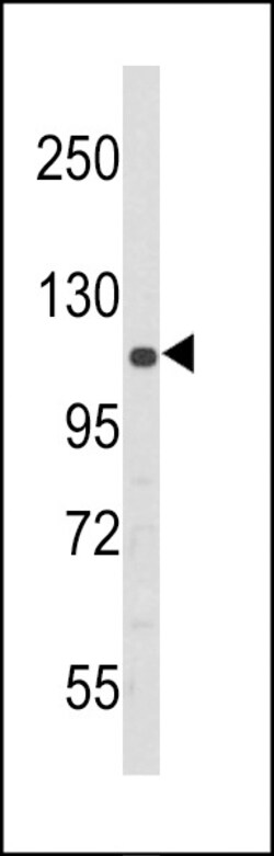 Invitrogen PERK Polyclonal Antibody 400 &mu;L; Unconjugated:Antibodies,