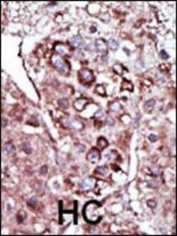 Invitrogen DGKZ Polyclonal Antibody 400 &mu;L; Unconjugated:Antibodies,
