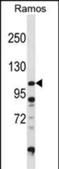 Invitrogen DGKZ Polyclonal Antibody 400 &mu;L; Unconjugated:Antibodies,