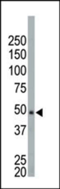 Invitrogen NEK2 Polyclonal Antibody 400 &mu;L; Unconjugated:Antibodies,