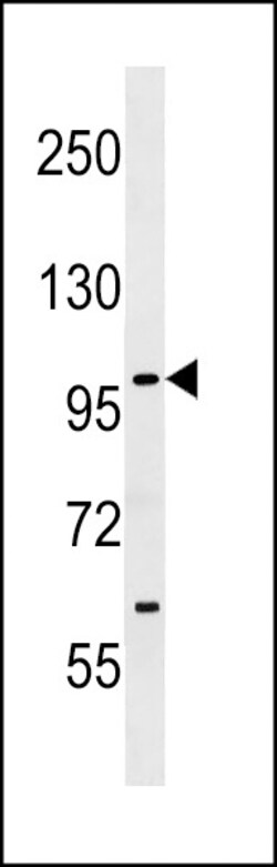 Invitrogen SIK1 Polyclonal Antibody 400 μL; Unconjugated:Antibodies,