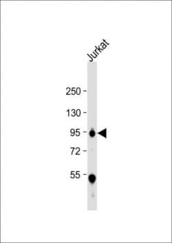 Invitrogen WEE1 Polyclonal Antibody 400 &mu;L; Unconjugated:Antikroppar