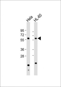 Invitrogen NPR3 Polyclonal Antibody 200 &mu;L; Unconjugated:Antibodies,