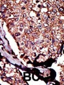 Invitrogen DGKB Polyclonal Antibody 400 &mu;L; Unconjugated:Antibodies,