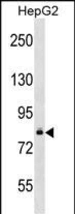 Invitrogen DGKB Polyclonal Antibody 400 &mu;L; Unconjugated:Antibodies,