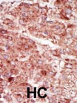 Invitrogen HK3 Polyclonal Antibody 400 &mu;L; Unconjugated:Antibodies,