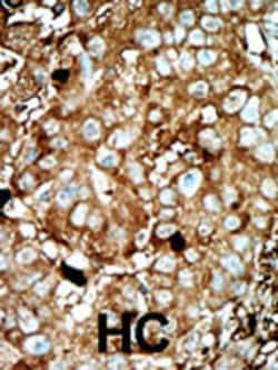 Invitrogen PFKFB3 Polyclonal Antibody 400 μL; Unconjugated:Antibodies,