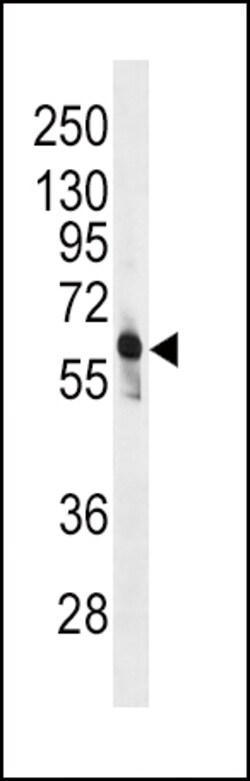 Invitrogen PFKFB3 Polyclonal Antibody 400 μL; Unconjugated:Antibodies,
