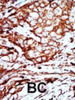 Invitrogen 14-3-3 beta Polyclonal Antibody 400 &mu;L; Unconjugated:Antibodies,