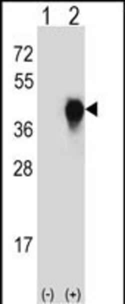 Invitrogen uPAR Polyclonal Antibody 400 &mu;L; Unconjugated:Antibodies,