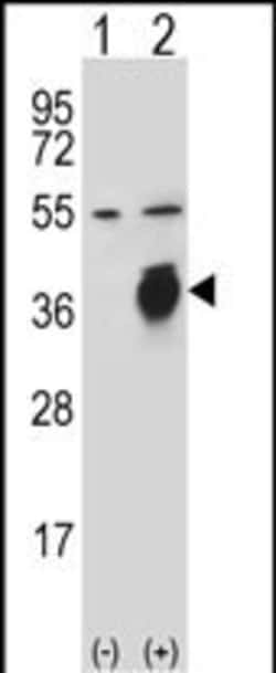 Invitrogen uPAR Polyclonal Antibody 400 &mu;L; Unconjugated:Antibodies,