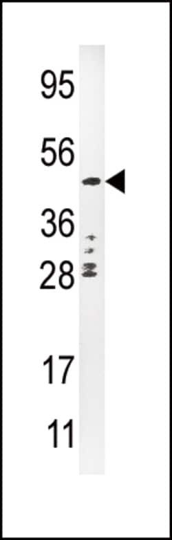 Invitrogen Urokinase Polyclonal Antibody 400 &mu;L; Unconjugated:Antibodies,