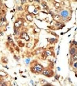 Invitrogen MAGI1 Polyclonal Antibody 400 &mu;L; Unconjugated:Antibodies,