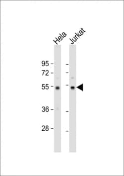 Invitrogen PTP1B Polyclonal Antibody 400 &mu;L | Buy Online | Invitrogen&trade; | Fisher Scientific