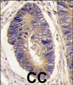 Invitrogen PTPN3 Polyclonal Antibody 400 &mu;L; Unconjugated:Antibodies,