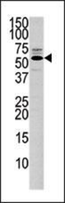 Invitrogen PTEN Polyclonal Antibody 400 &mu;L; Unconjugated:Antibodies,