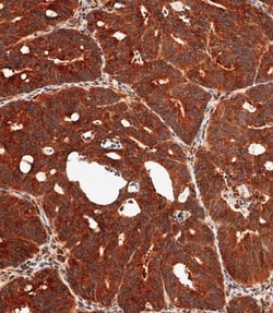 Invitrogen MKP3 Polyclonal Antibody 400 &mu;L; Unconjugated:Antibodies,
