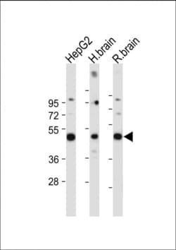 Invitrogen MKP3 Polyclonal Antibody 400 &mu;L; Unconjugated:Antibodies,