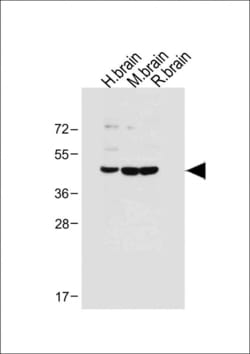 Invitrogen MKP3 Polyclonal Antibody 400 &mu;L; Unconjugated:Antibodies,