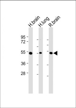 Invitrogen MKP3 Polyclonal Antibody 400 &mu;L; Unconjugated:Antibodies,