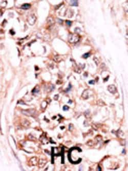 Invitrogen DUSP14 Polyclonal Antibody 400 &mu;L; Unconjugated:Antibodies,