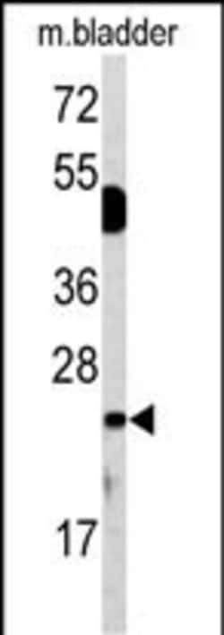 Invitrogen DUSP14 Polyclonal Antibody 400 &mu;L; Unconjugated:Antibodies,