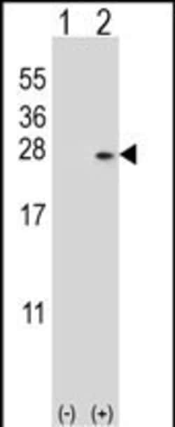 Invitrogen DUSP14 Polyclonal Antibody 400 &mu;L; Unconjugated:Antibodies,
